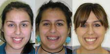 Orthodontic Services