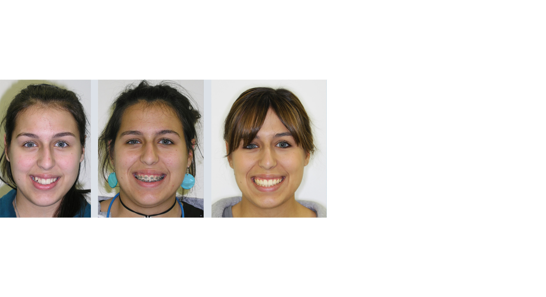 Orthodontic Services