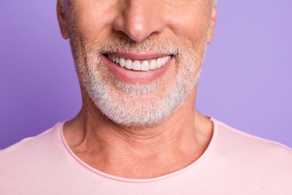 The Step By Step Process Of Getting Dental Veneers