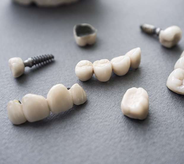 Swansea The Difference Between Dental Implants and Mini Dental Implants